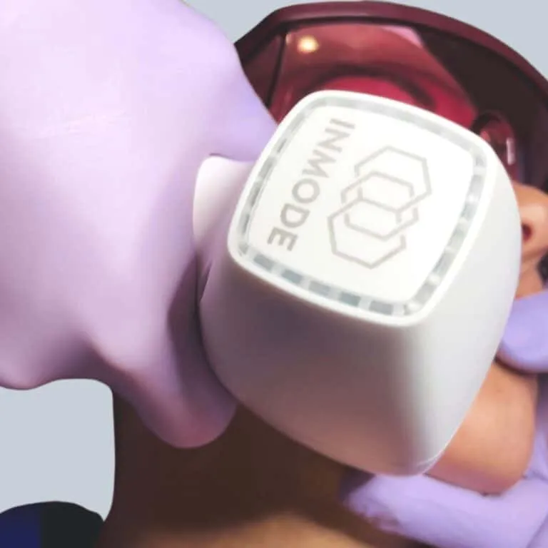 laser hair removal pasadena md