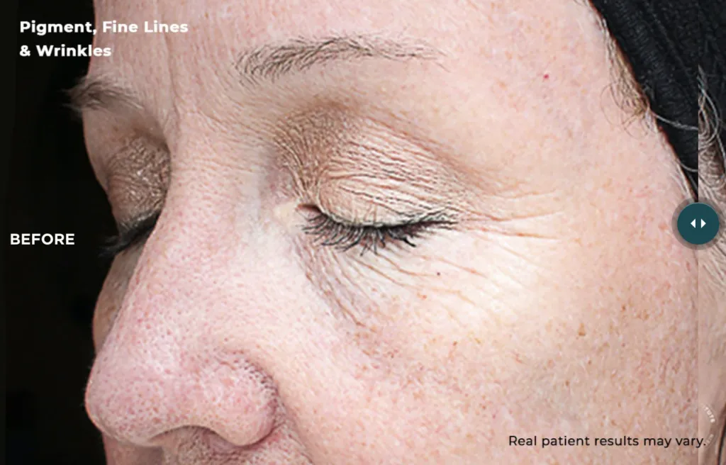 Close-up of wrinkles and fine lines on skin.