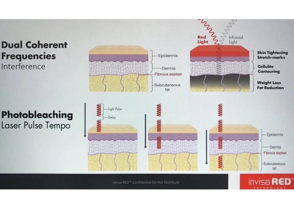Diagram of red light skin treatment layers